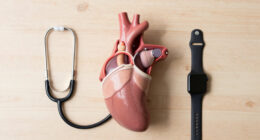 Aortic Dissection